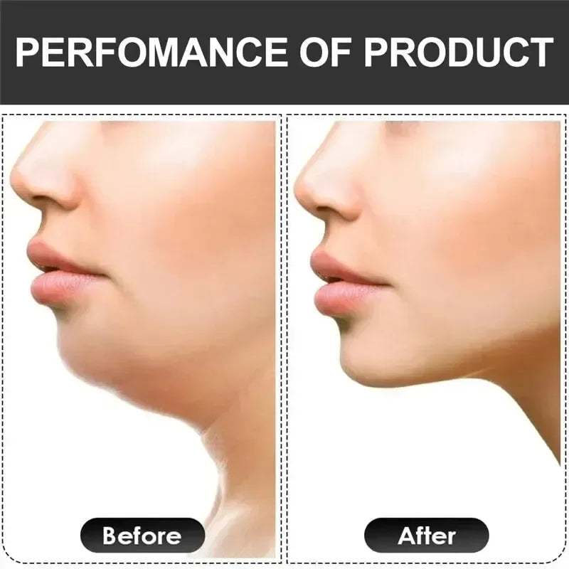 U Shape Jaw Exerciser
