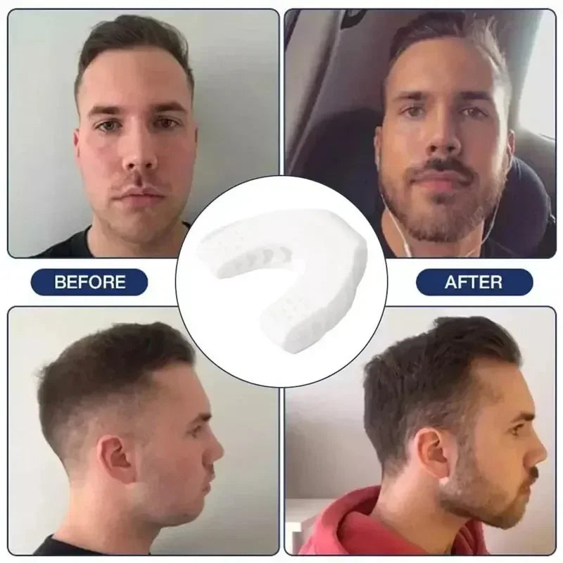 U Shape Jaw Exerciser